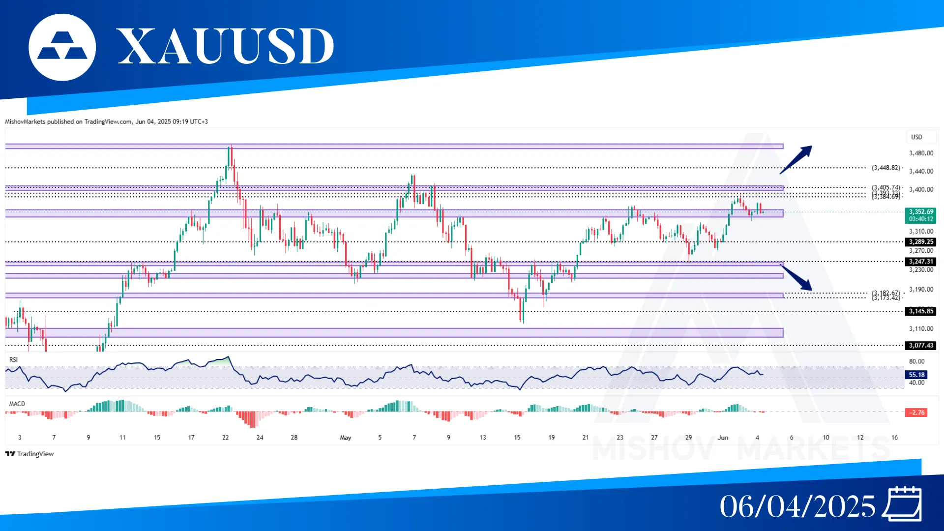 XAUUSD GOLD TECHNICAL ANALYSIS